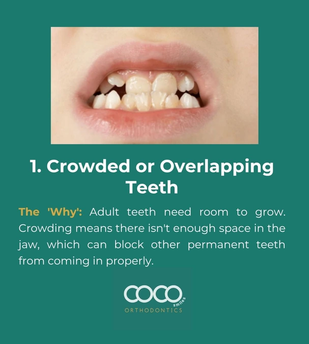 Phase One Treatment example 1