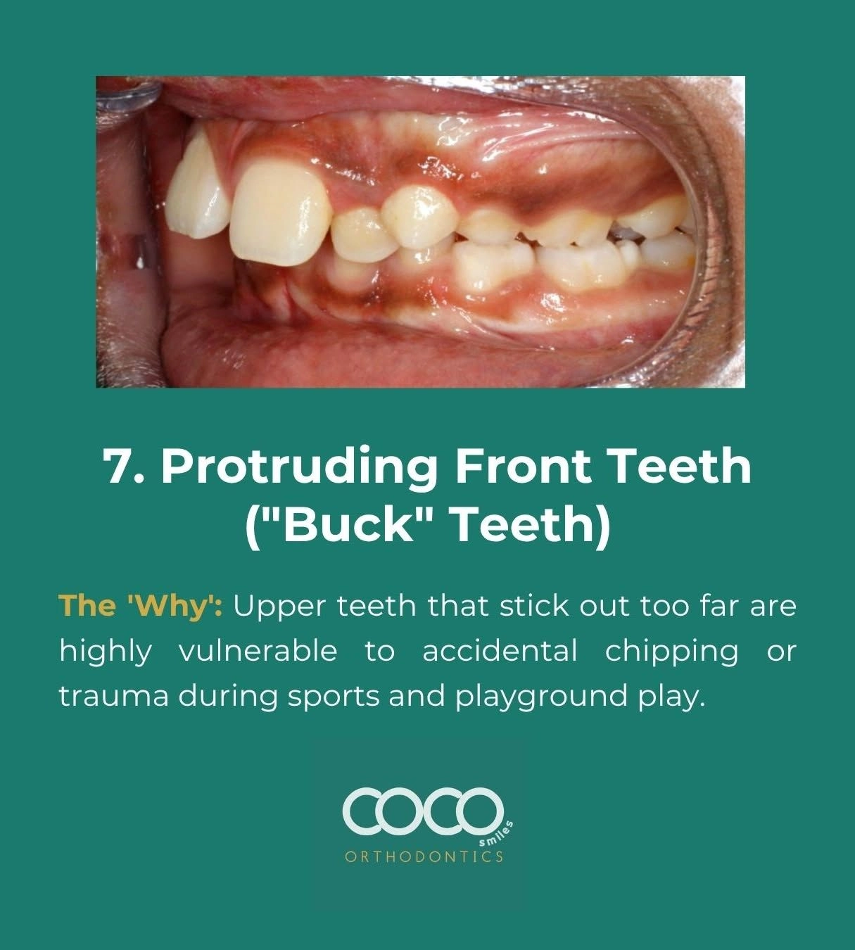Phase One Treatment example 7